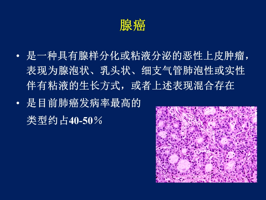 肺癌分类与分子靶点课件.ppt_第3页