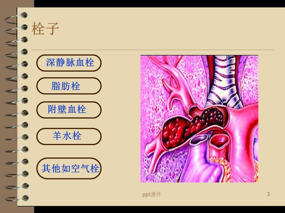 肺栓塞【心内科】课件.ppt_第3页