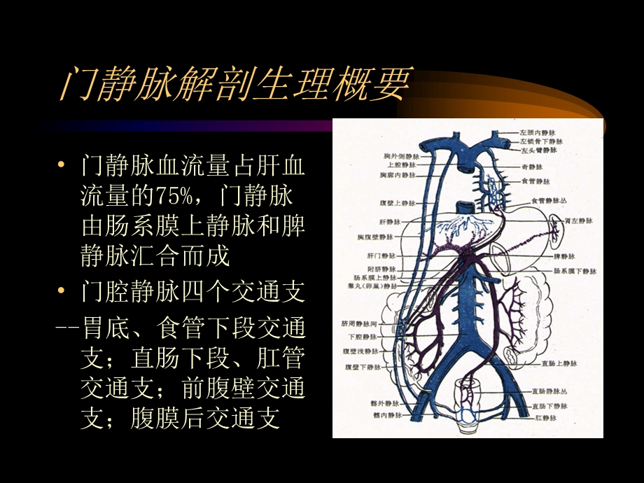 第十六章 门静脉高压症课件.ppt_第3页