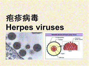 疱疹病毒完整课件.ppt