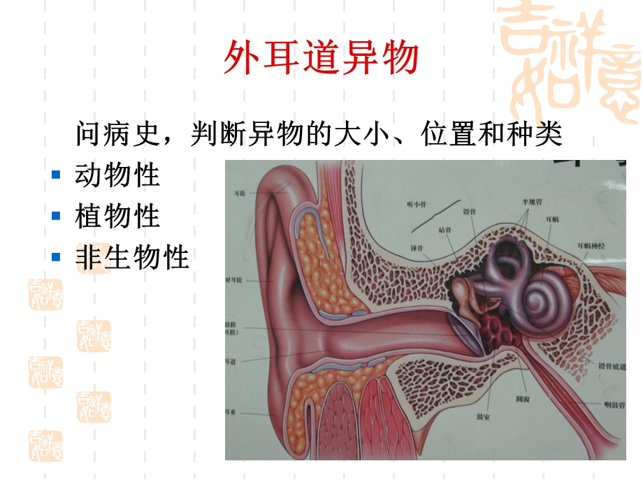 耳科常见急症处理课件.ppt_第3页