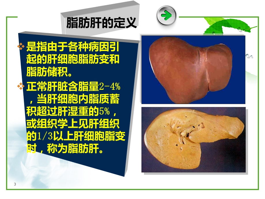 脂肪肝健康宣教课件.ppt_第3页