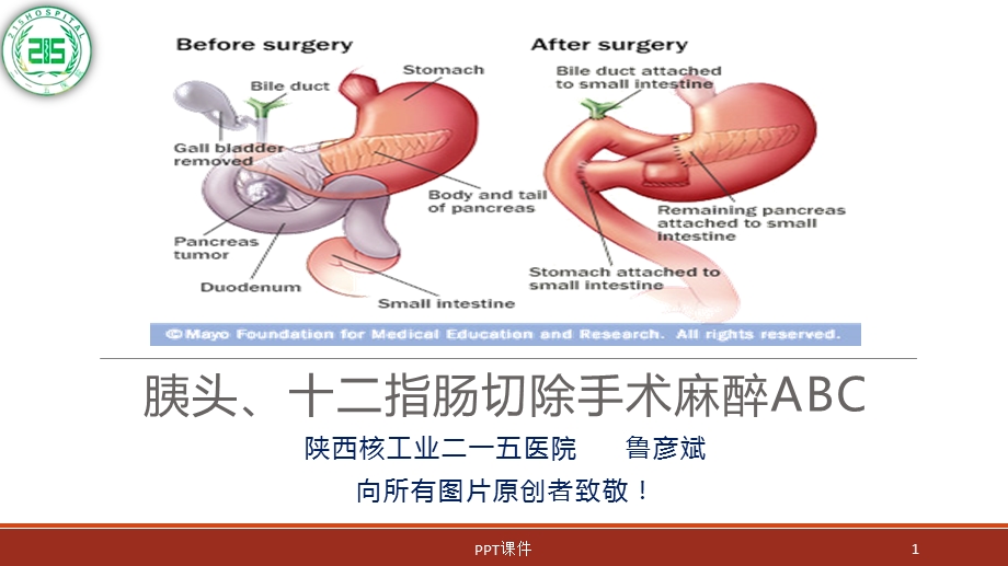 胰腺、十二指肠手术麻醉课件.ppt_第1页