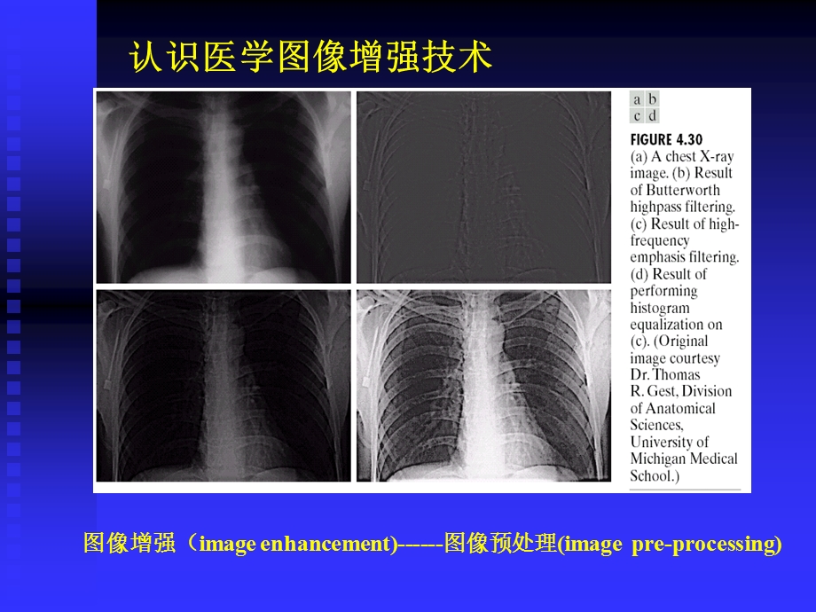 第五章ct增强课件.ppt_第2页