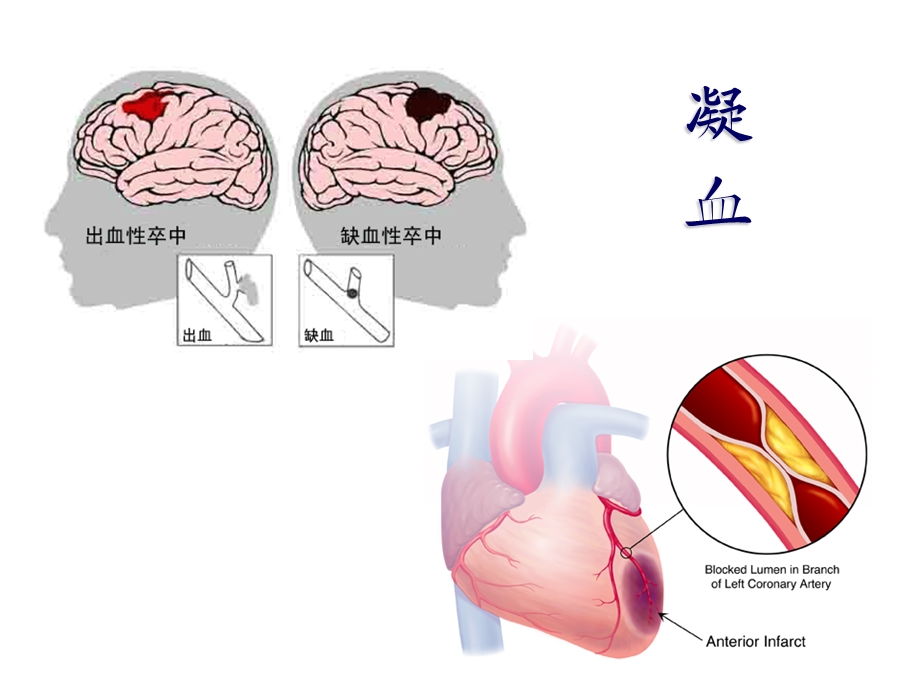 血液系统疾病的临床用药课件.ppt_第3页