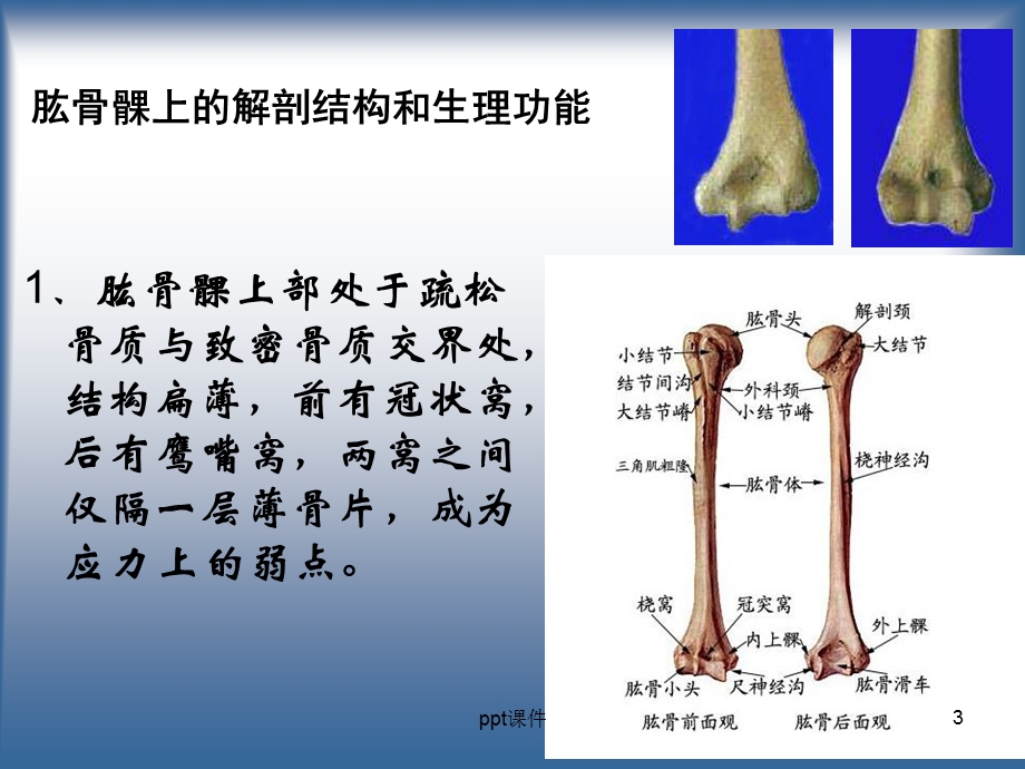 肱骨髁上骨折课件.ppt_第3页