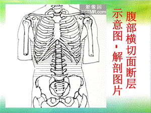 腹部断层解剖和断层CT(上)课件.ppt