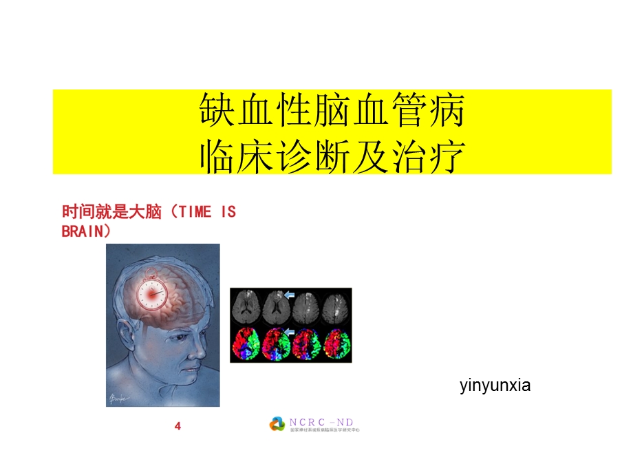 缺血性脑血管病诊断及治疗课件.ppt_第1页