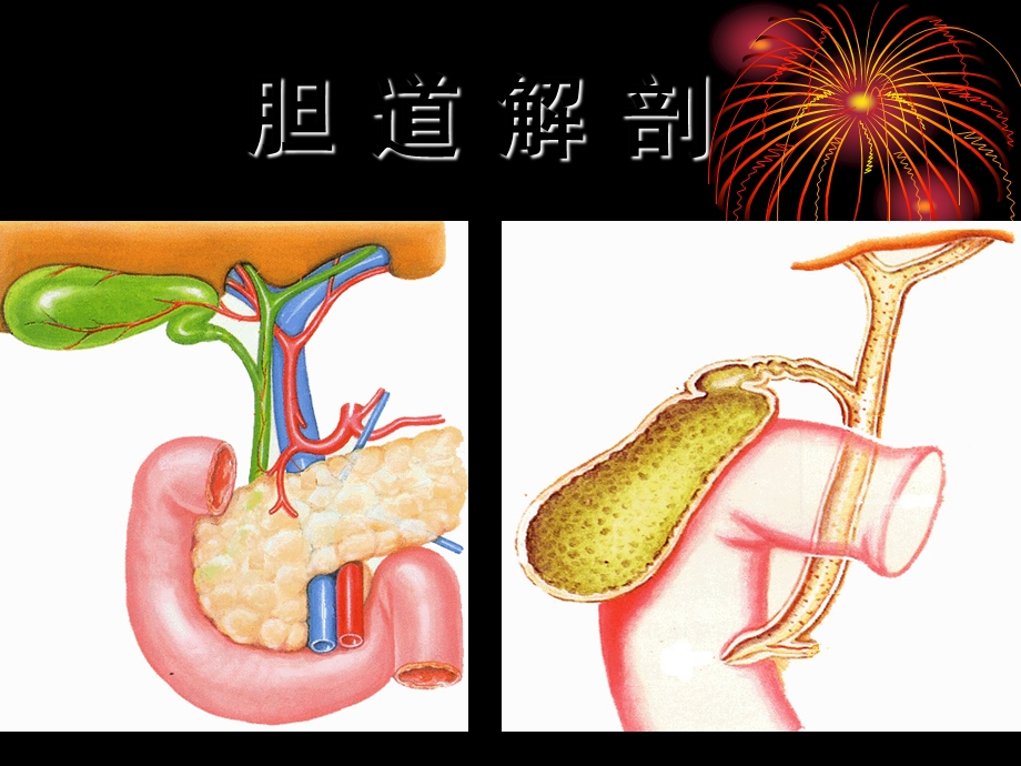 结石性胆囊炎的诊治课件.ppt_第3页