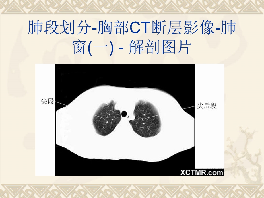 胸腹盆CT详细实用图解课件.ppt_第3页