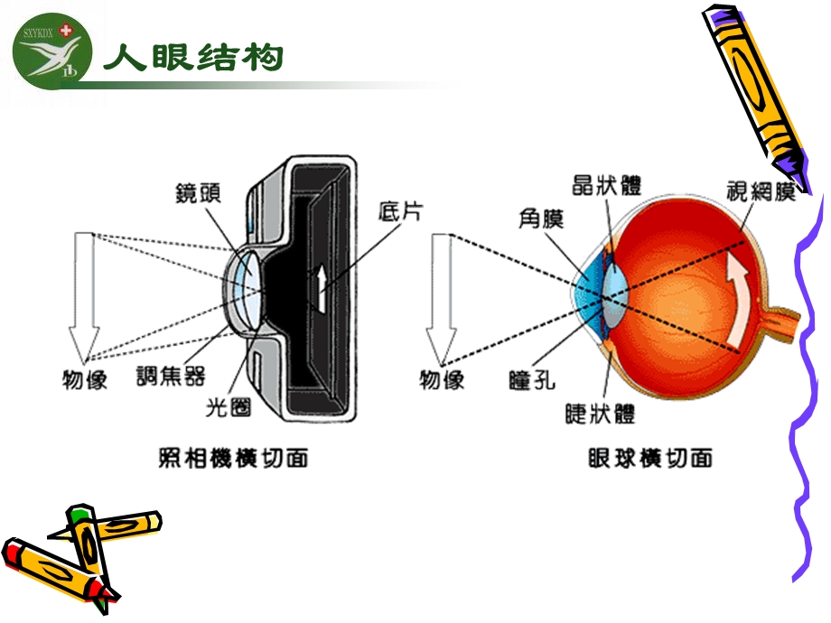 白内障宣教课件.ppt_第2页