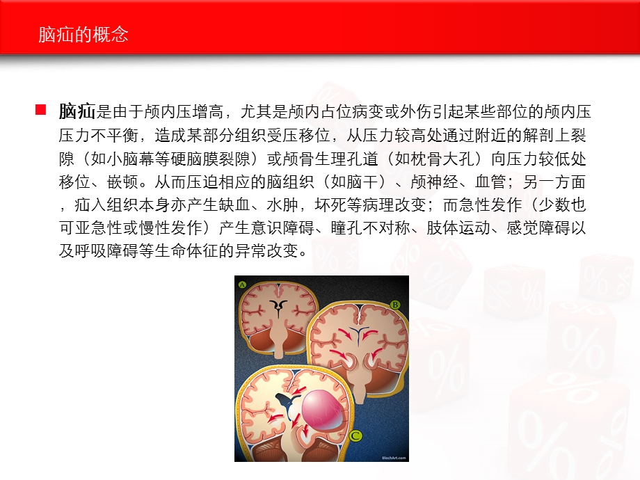 脑疝的急救与护理课件.ppt_第3页