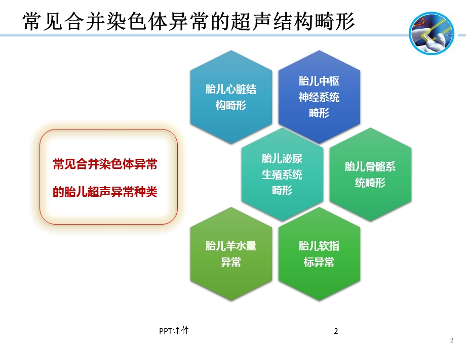 胎儿超声结构异常的遗传学诊断课件.ppt_第2页