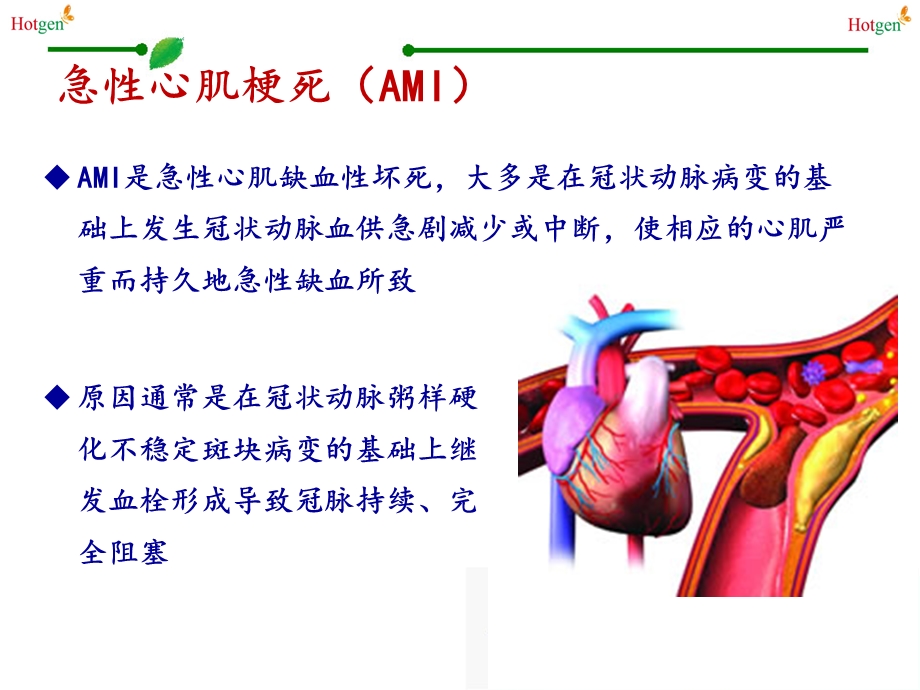 肌钙蛋白(热景生物)课件.pptx_第3页