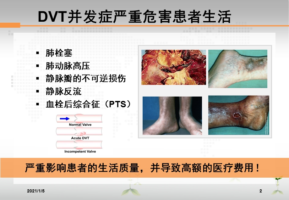 骨科大手术后VTE预防课件.ppt_第2页