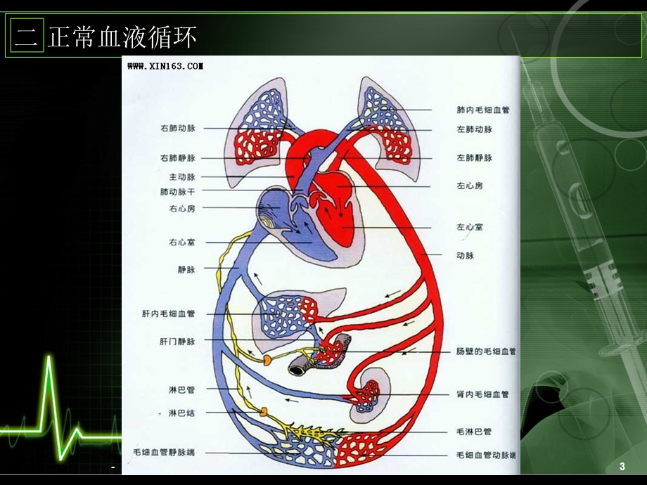 先心病围手术期的护理课件.ppt_第3页