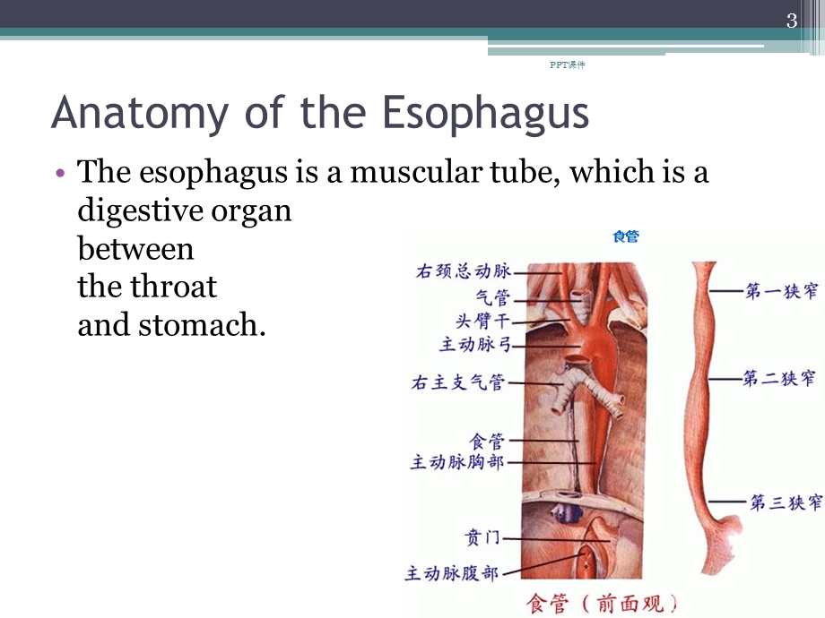 食管癌(英文版)课件.ppt_第3页