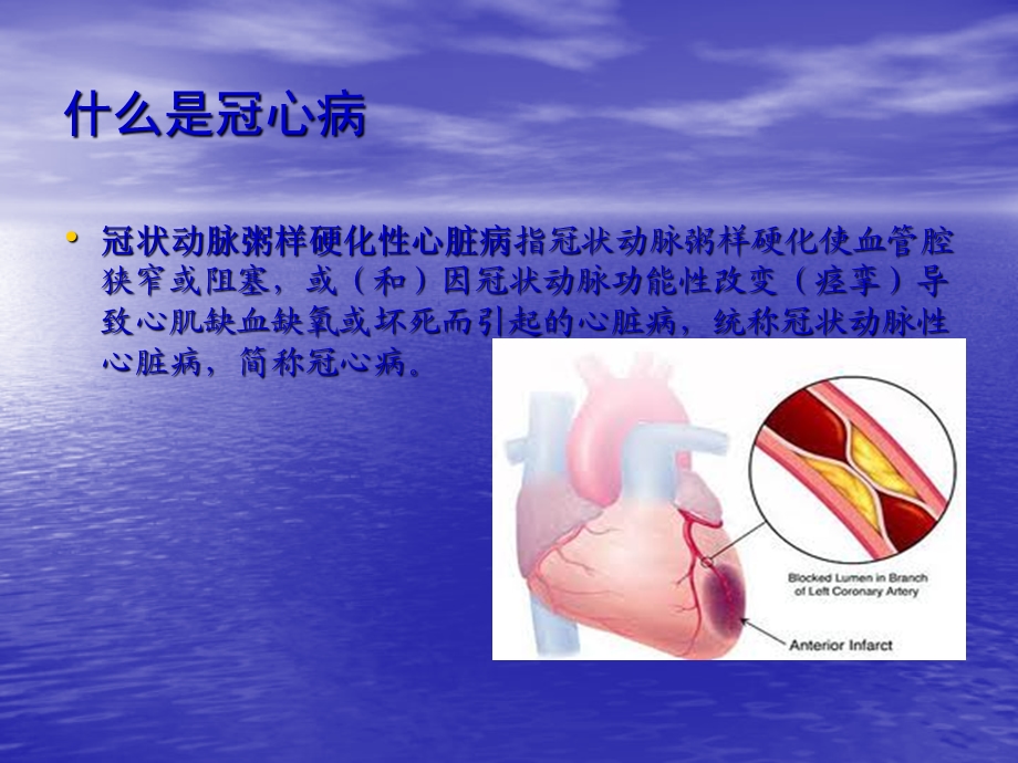 冠心病的健康宣教课件.ppt_第2页