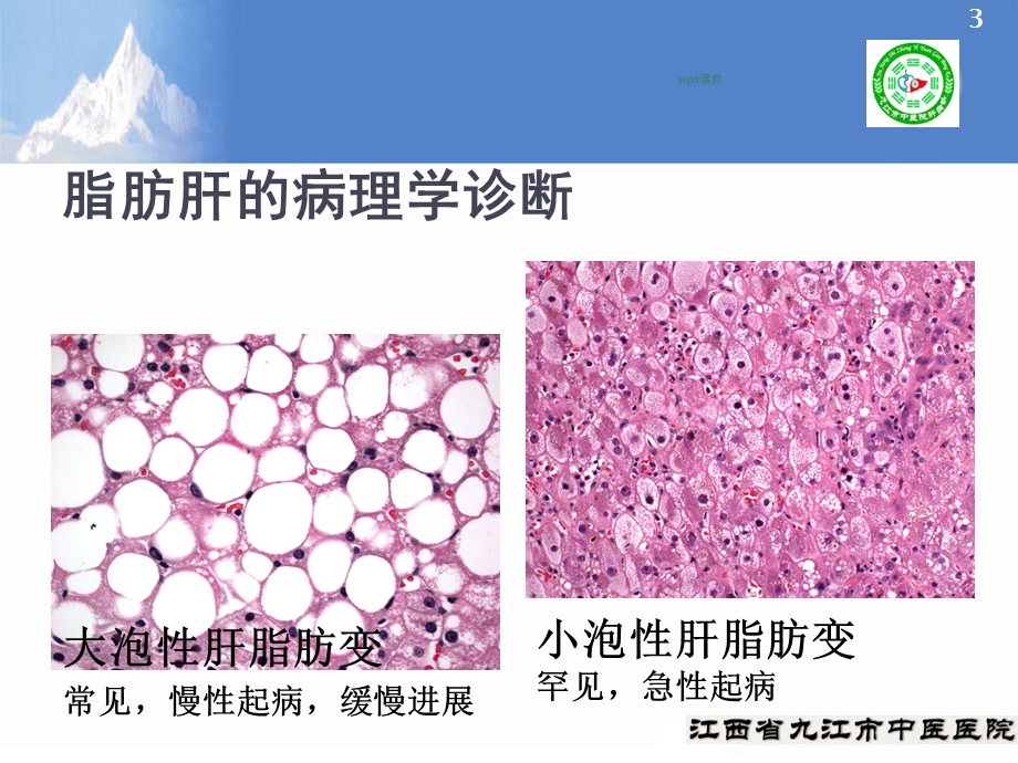 非酒精性脂肪性肝病防治指南课件.ppt_第3页