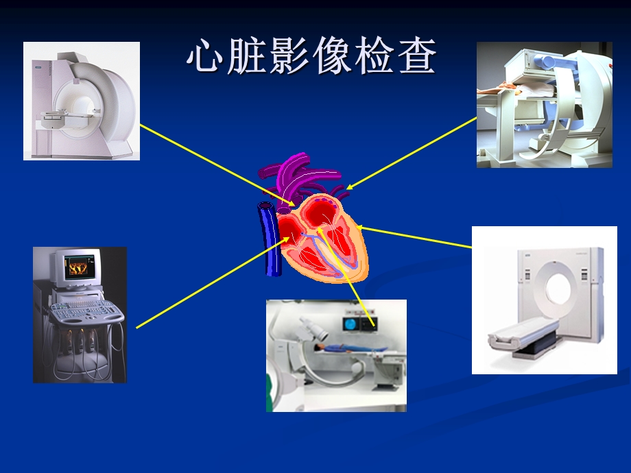 冠状动脉CT血管成像课件.ppt_第2页