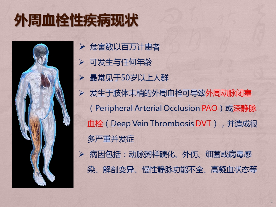 AngioJet血栓抽吸系统介绍课件.pptx_第2页