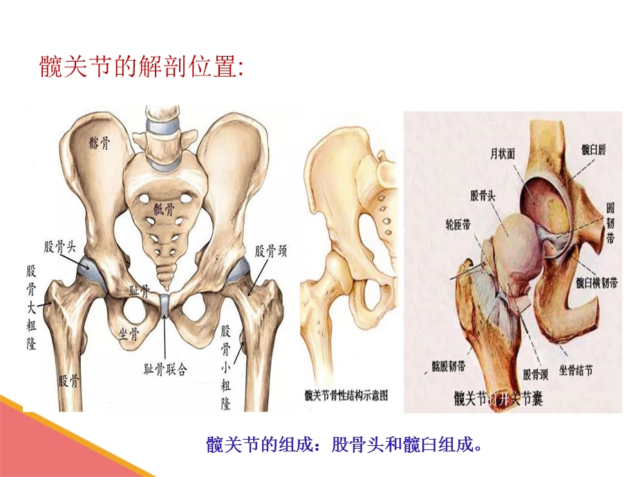 髋关节置换术叶丽课件.ppt_第3页