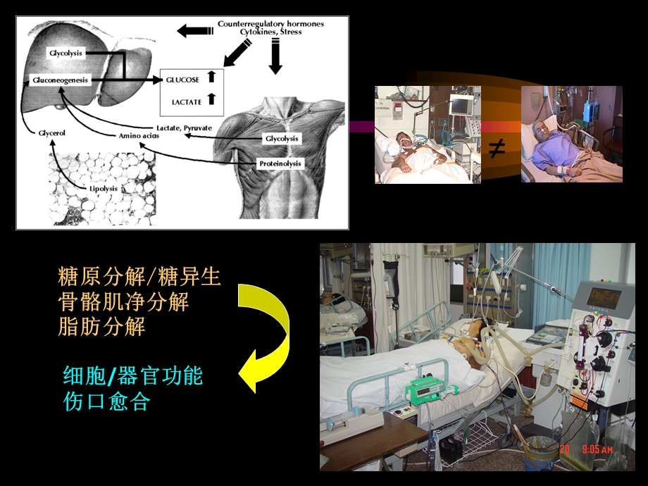 重症患者营养治疗(压疮护理学习班)课件.ppt_第2页