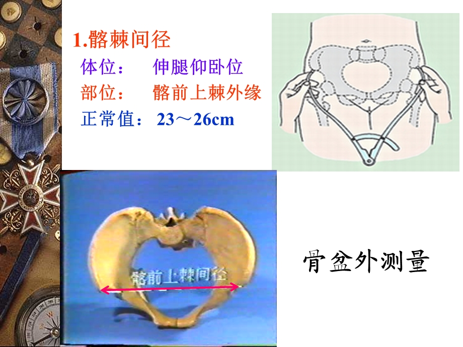 骨盆、正常产程、课件.ppt_第3页