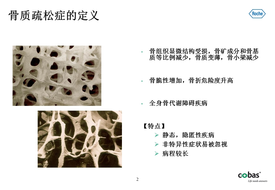 骨标志物检测的临床应用课件.ppt_第2页