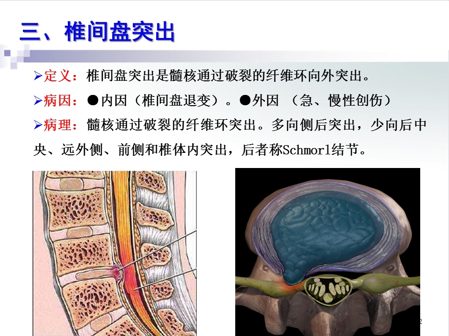 运动系统影像学检查二课件.ppt_第2页