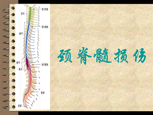 颈脊髓损伤教材课件.ppt