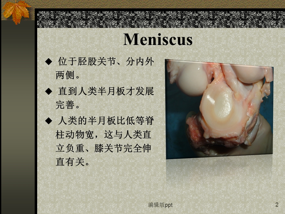 半月板损伤的诊断与治疗医学课件.ppt_第2页