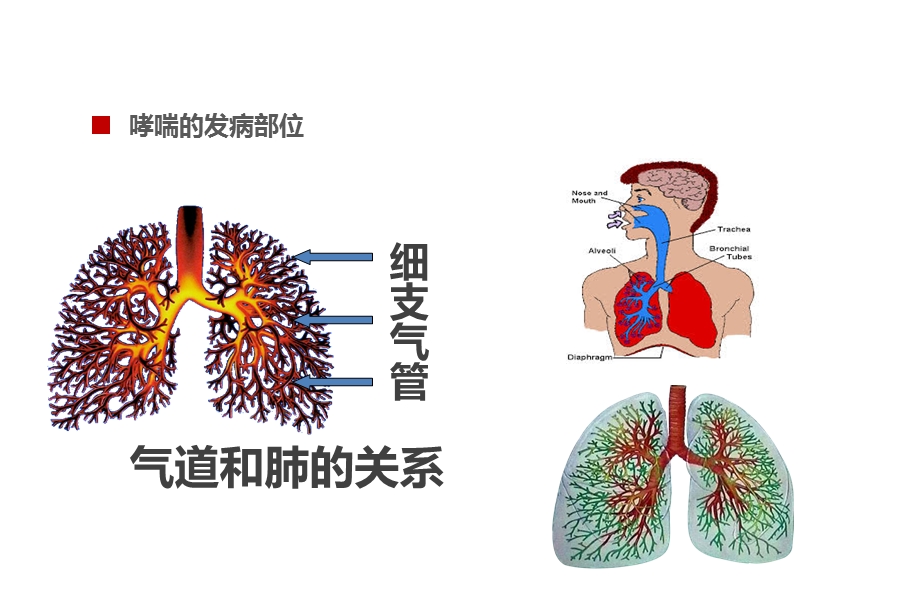 儿童哮喘防治ppt课件.pptx_第3页