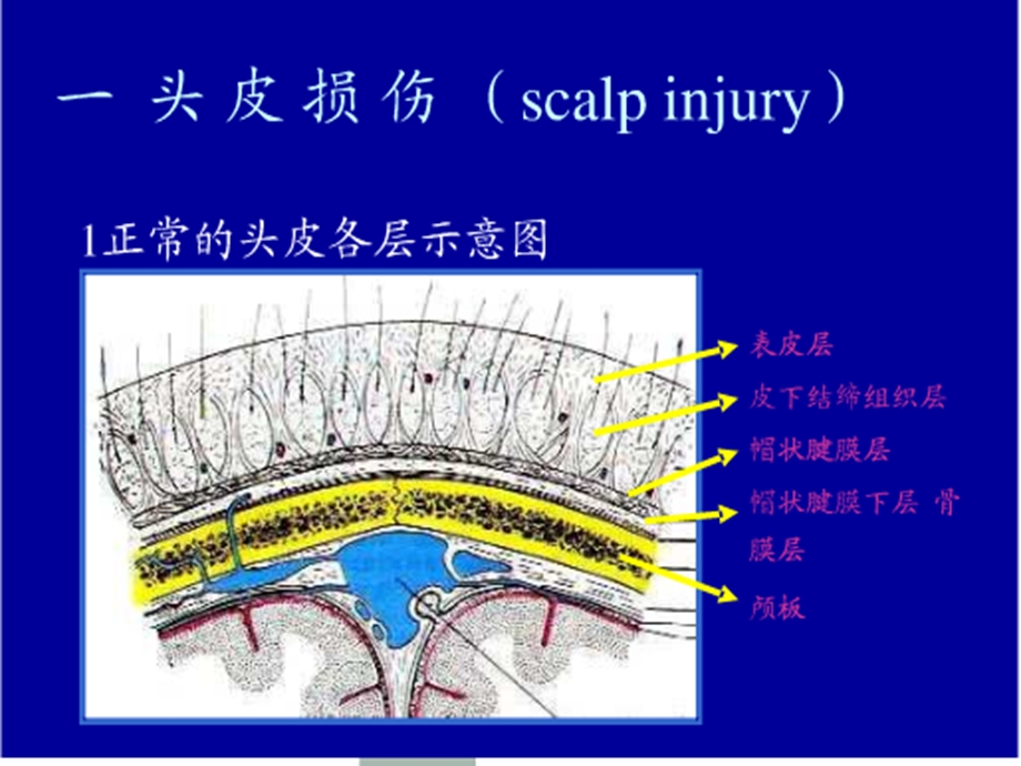 颅脑外伤的救治课件.ppt_第3页