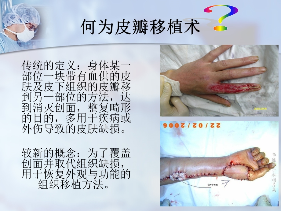 骨科患者的护理查房课件.ppt_第2页