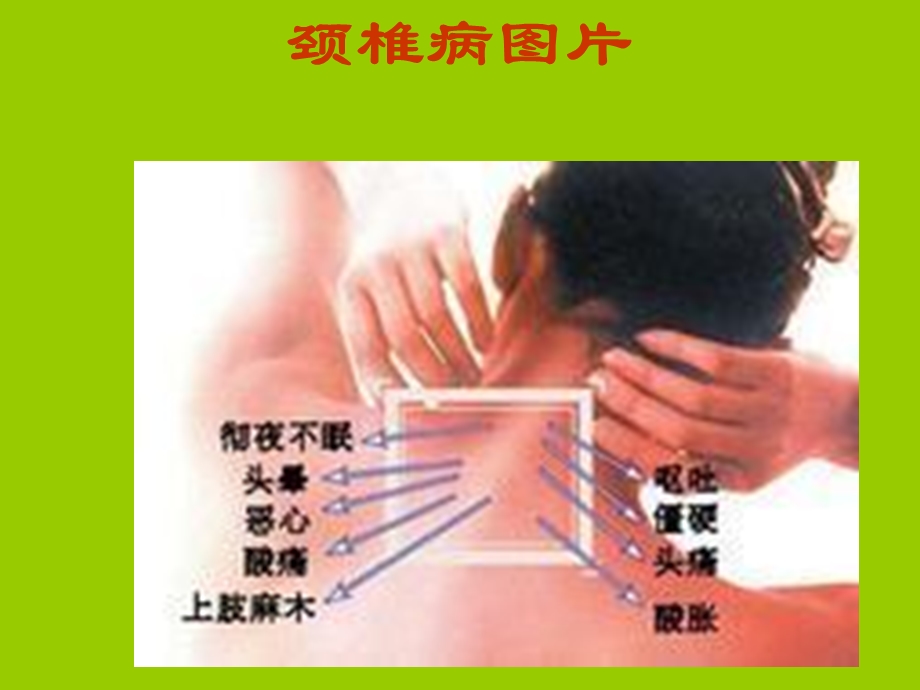 颈椎病防治课件.ppt_第3页