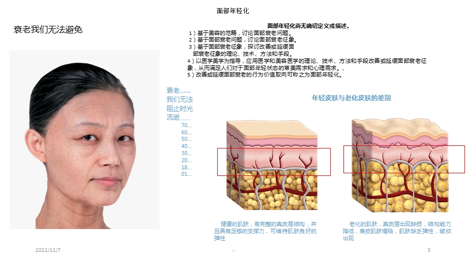 埋线提升——线雕课件.ppt_第3页