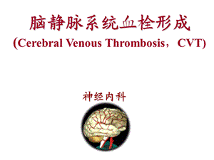 颅内静脉血栓形成课件.ppt