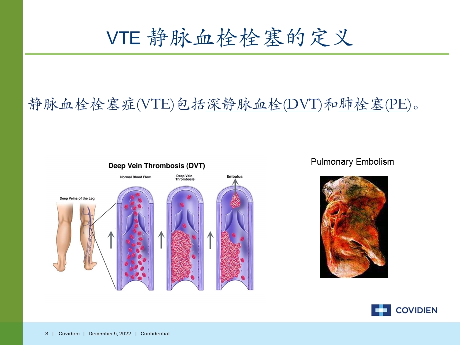 医院血栓预防介绍血栓TED课件.ppt_第3页