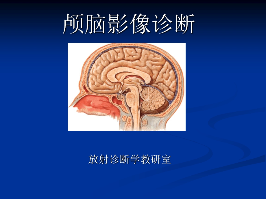 颅脑影像(神内)课件.ppt_第1页