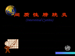 间质性膀胱正文课件.ppt