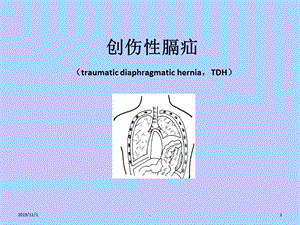 创伤性膈疝课件.ppt