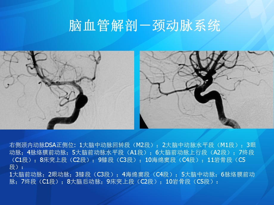 动脉瘤讲课ppt课件.ppt_第2页