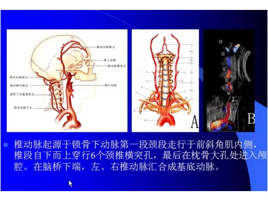 颈部血管超声检查课件.ppt_第3页