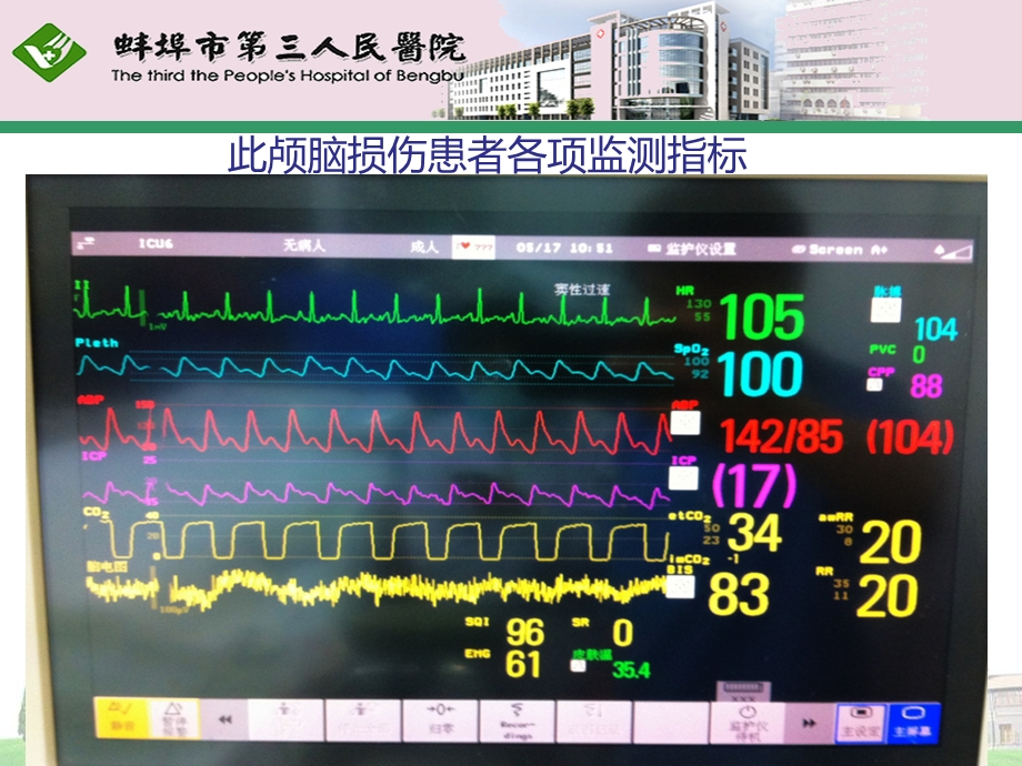 重症脑损伤患者的镇痛镇静治疗课件.ppt_第3页