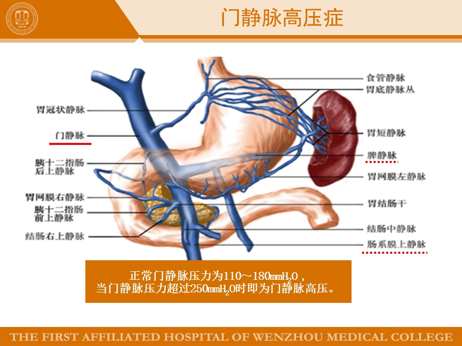 门静脉高压的内镜治疗课件.ppt_第3页