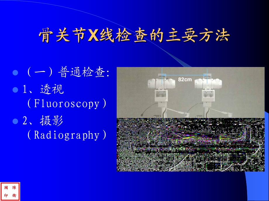 骨关节x线诊断课件.ppt_第3页