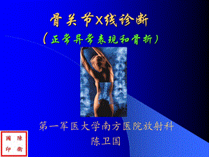 骨关节x线诊断课件.ppt