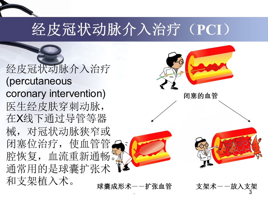 介入术前带教课件.ppt_第3页