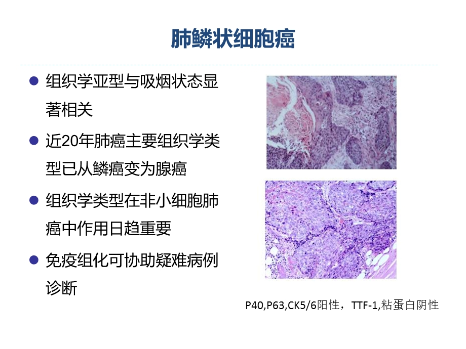 肺鳞癌个体化治疗现状与前景演示ppt课件.ppt_第3页